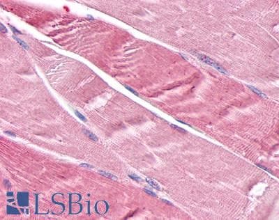 IHC-plus™ TNIK Antibody (Internal)