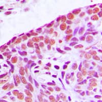 MAP3K3 / MEKK3 Antibody (Internal)
