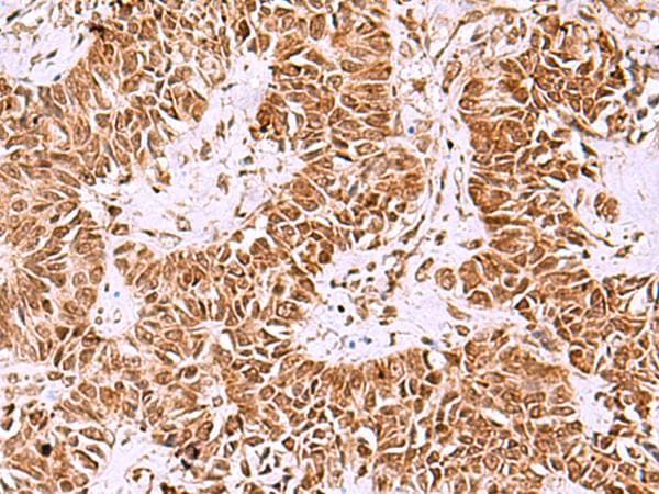 IRX1 Antibody