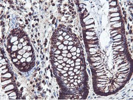 PSMB7 Antibody (clone OTI1E1)