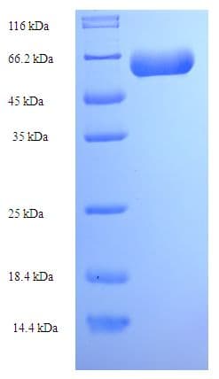 Human ACTL7A Protein (Recombinant His-SUMO)
