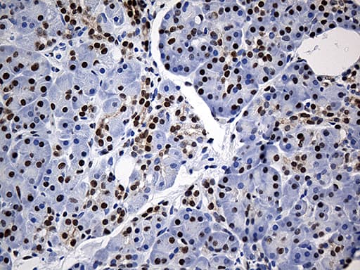 HNRNPH1 / hnRNP H Antibody (clone OTI5D11)