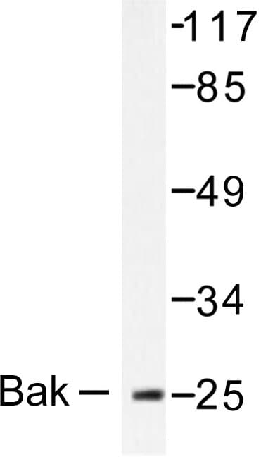 BAK1 / BAK Antibody (Ala2)