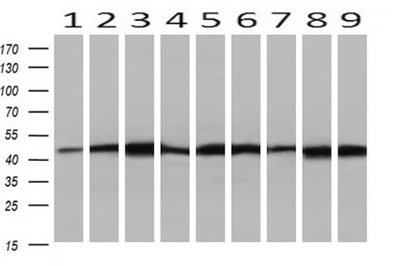 SETD7 / SET7 Antibody (clone OTI2D10)