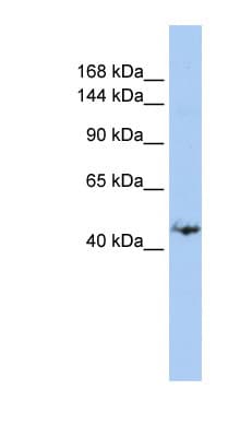GREB1 Antibody (aa144-193)