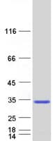 Human RNF141 Protein (Recombinant Myc-DDK (Flag))