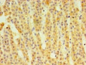 HSD11B1 / HSD11B Antibody (aa25-292, HRP)