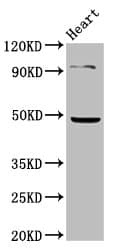 Polyclonal Rabbit anti-Human KCNJ5 / Kir3.4 / GIRK4 Antibody (IHC, IF, WB)