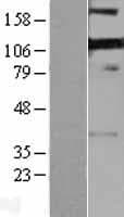 PDLIM4 / RIL Protein (Over-Expression Lysate Myc-DDK (Flag))