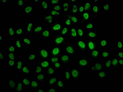 Polyclonal Rabbit anti-Human HIST1H2BN Antibody (IHC, IF, WB)