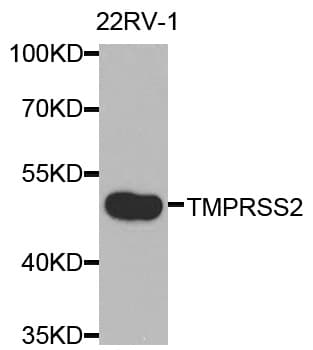 IHC-plus™ Polyclonal Rabbit anti-Human TMPRSS2 / Epitheliasin Antibody (IHC, WB)