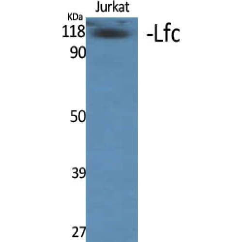 ARHGEF2 / GEF-H1 Antibody (820-900 aa)
