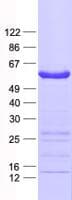 Human ELK4 Protein (Recombinant His, N-Terminal)