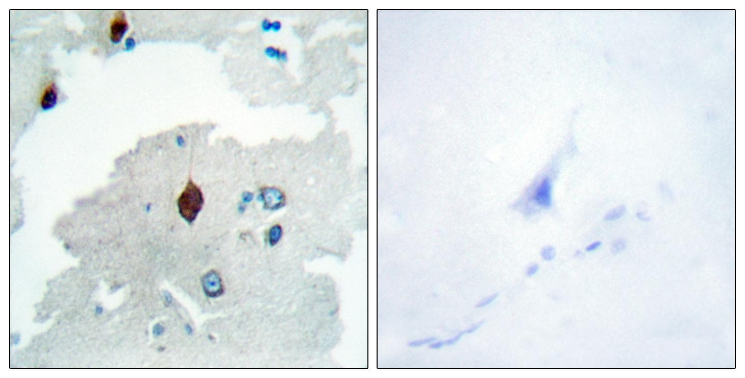 Polyclonal Rabbit anti-Human PTTG1IP / PBF Antibody (IHC, WB)