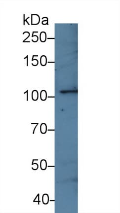 SMARCA3 / HLTF Antibody (aa831-990)