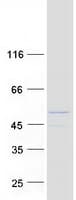 Human ZSWIM1 Protein (Recombinant Myc-DDK (Flag))