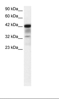 POU2F3 / PLA-1 Antibody (N-Terminus, HRP)
