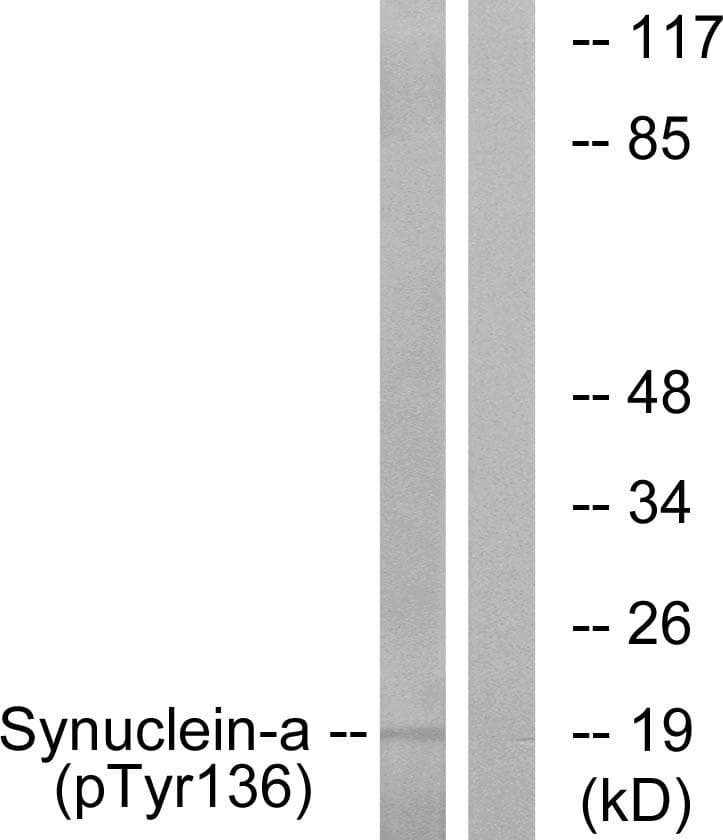 SNCA / Alpha-Synuclein Antibody (phospho-Tyr136)