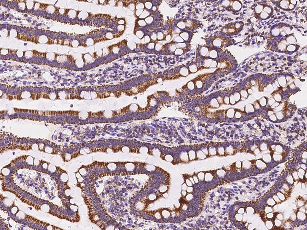 PECR Antibody