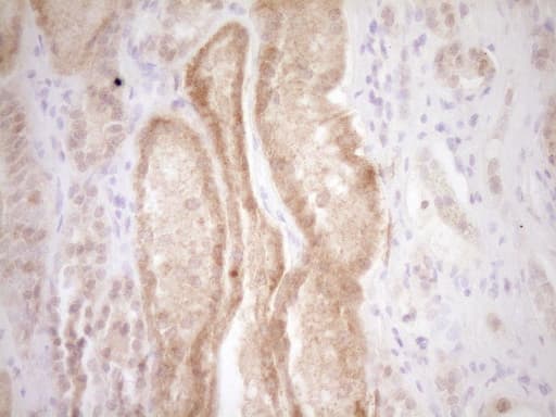 Monoclonal Mouse anti-Human TRB3 / TRIB3 Antibody (clone OTI3C6, aa1-200, IHC, WB)