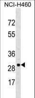 VDAC3 Antibody (aa156-183)