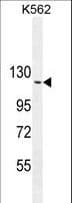 IHC-plus™ ARHGAP17 / NADRIN Antibody (aa41-70)