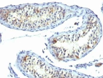 PRLR / Prolactin Receptor Antibody (clone B6.2)