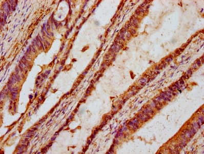 Polyclonal Rabbit anti-Human TTI2 / C8orf41 Antibody (IHC, IF, WB)