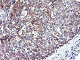 NMT2 Antibody (clone OTI1B4)