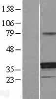Human HSD11B1 / HSD11B Protein (Over-Expression Lysate Myc-DDK (Flag))