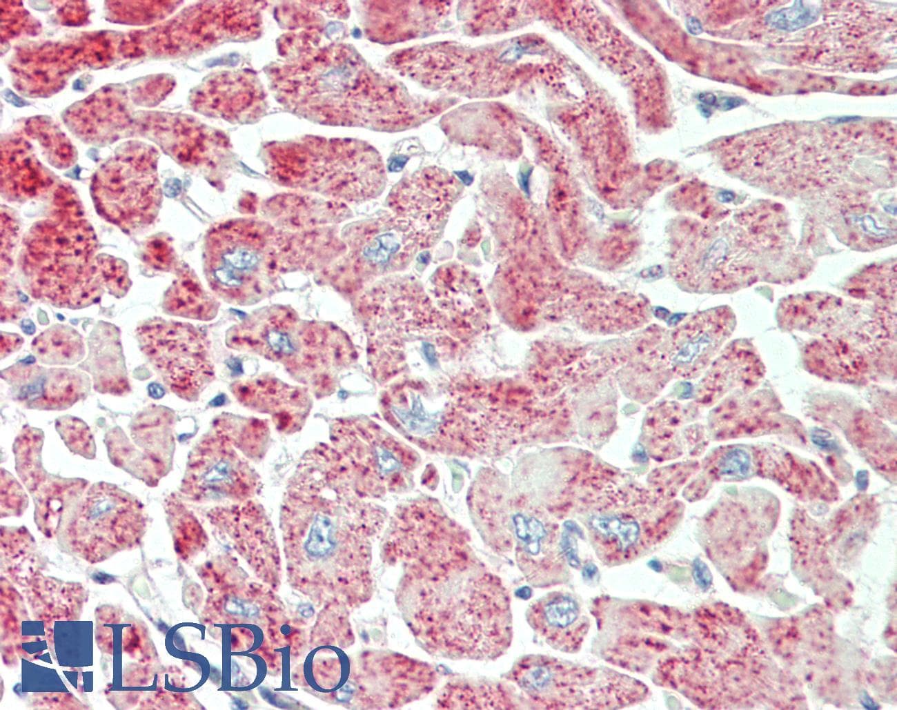 IHC-plus™ PDLIM5 / LIM Antibody (aa546-596)