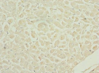 Polyclonal Rabbit anti-Human DRAM2 Antibody (IHC, IF, WB)