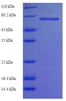 Human STK25 Protein (Recombinant His-SUMO)