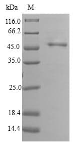Human PPP3R2 Protein (Recombinant GST, N-terminus)