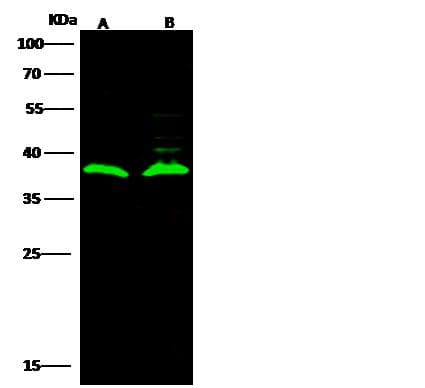 LRRC3B Antibody (Preservative Free)