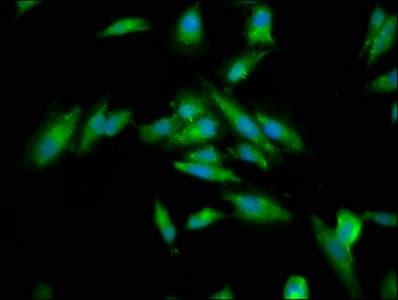 CKAP5 / ch-TOG Antibody