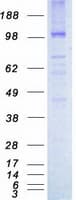 Human TIE1 / TIE Protein (Recombinant Myc-DDK (Flag))