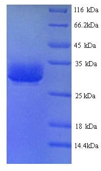 Calloselasma rhodostoma Thrombin-Like Enzyme ancrod Protein (Recombinant His)