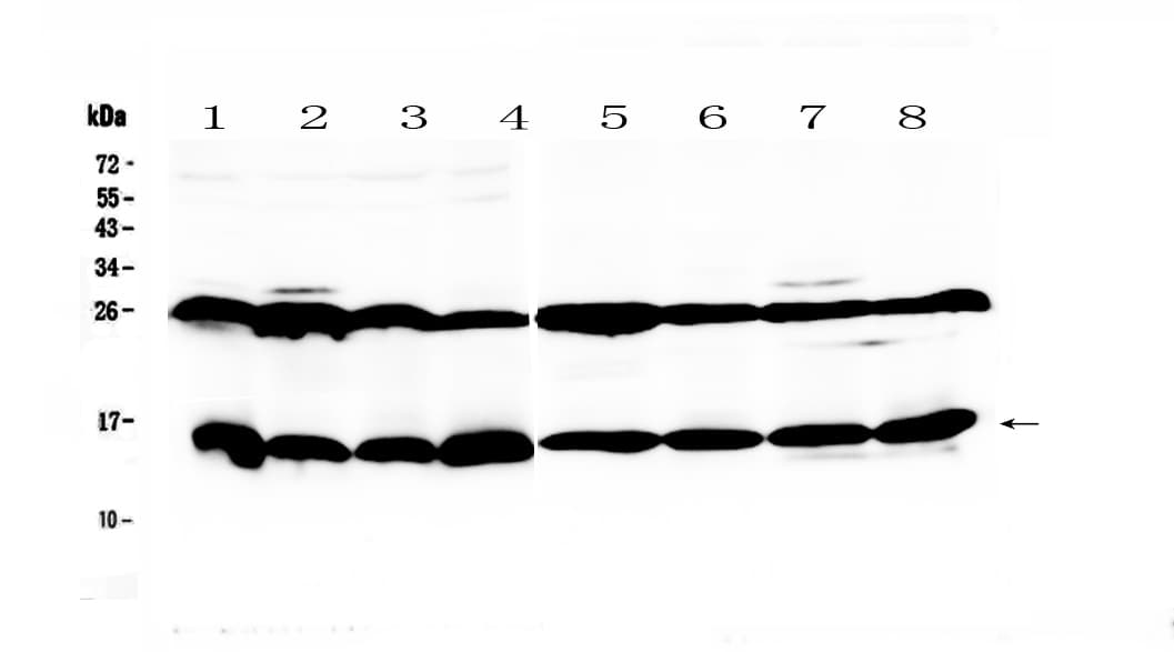 LGALS1 / Galectin 1 Antibody
