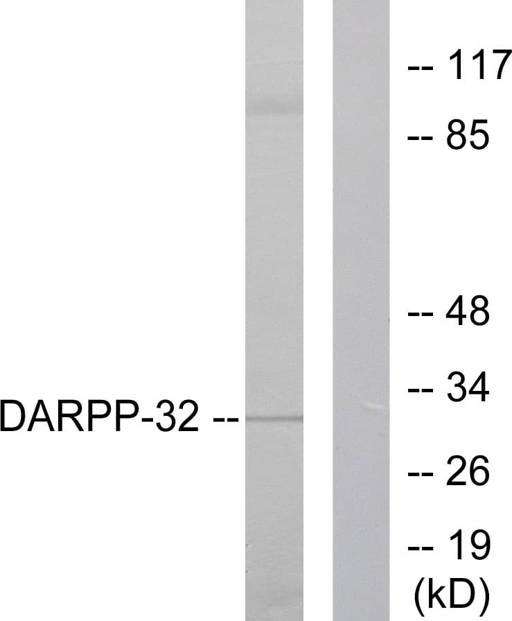 Polyclonal Rabbit anti-Human PPP1R1B / DARPP-32 Antibody (aa41-90, IHC, WB)