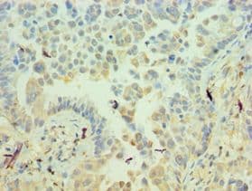 ICAM2 / CD102 Antibody (aa25-223)