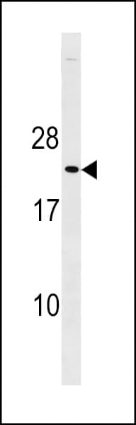CDKN1B / p27 Kip1 Antibody (aa175-197)