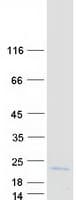 Human VAMP1 / VAMP-1 Protein (Recombinant Myc-DDK (Flag))