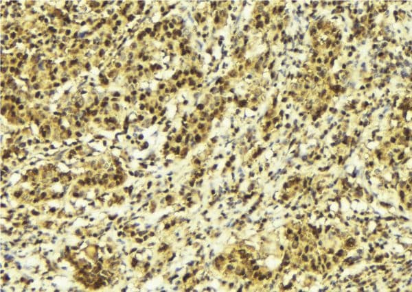 MLXIP / MONDOA Antibody