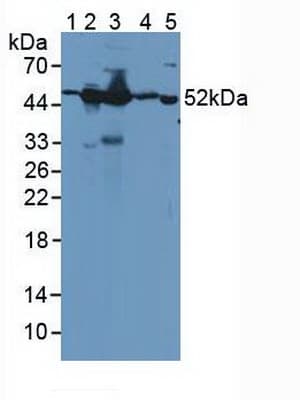 GDA / Nedasin Antibody (aa1-454, PE)