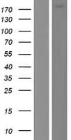 DOCK6 Protein (Over-Expression Lysate Myc-DDK (Flag))