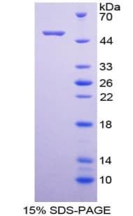 Human PKP1 / Plakophilin 1 Protein (Recombinant His-GST)