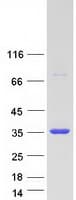 Human TIP30 / HTATIP2 Protein (Recombinant Myc-DDK (Flag))
