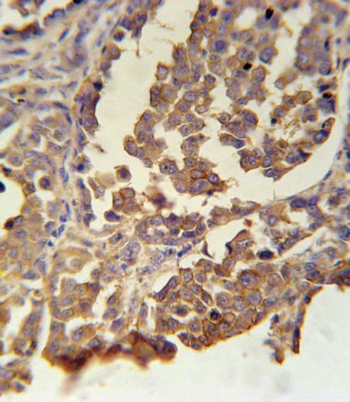 MC2R / ACTHR / ACTH Receptor Antibody (aa261-288)