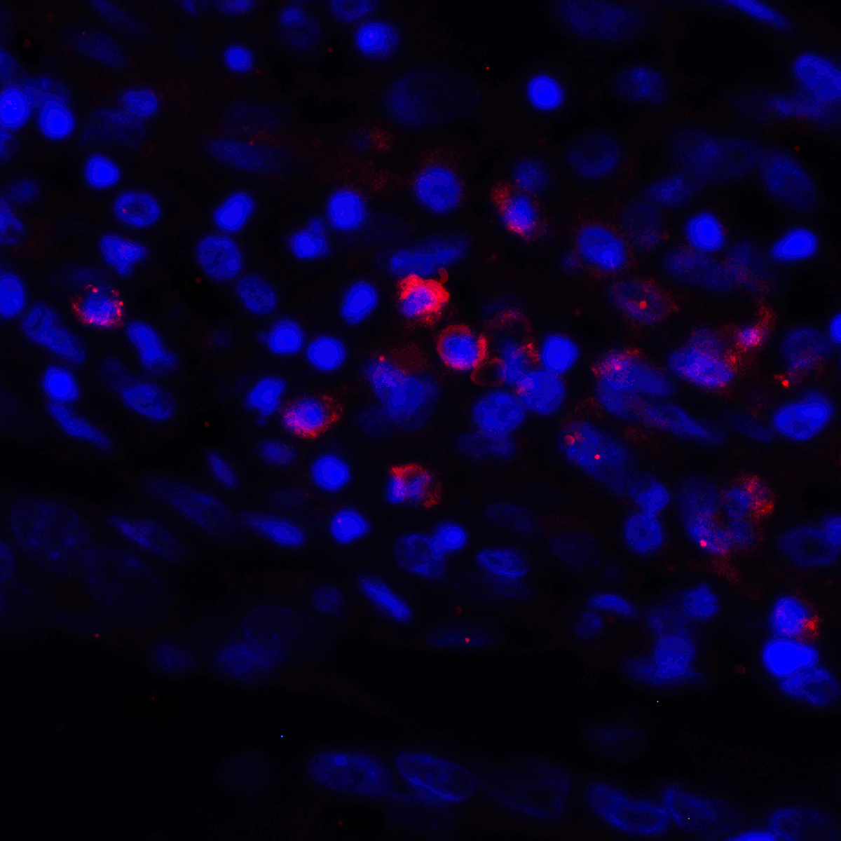 CD274 / B7-H1 / PD-L1 Antibody (clone 6H10)